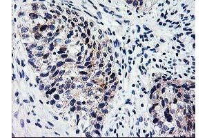 Image no. 2 for anti-X-Prolyl Aminopeptidase (Aminopeptidase P) 3, Putative (XPNPEP3) antibody (ABIN1501765)