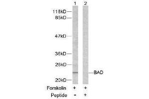 Image no. 2 for anti-BCL2-Associated Agonist of Cell Death (BAD) (Ser155) antibody (ABIN197213) (BAD anticorps  (Ser155))