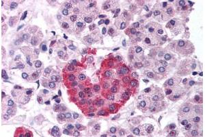 anti-Ubiquitin Specific Peptidase 3 (USP3) (AA 50-99) antibody