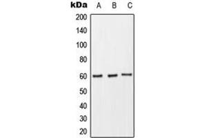 Western blot analysis of CD89 expression in THP1 (A), Raw264. (FCAR anticorps  (Center))