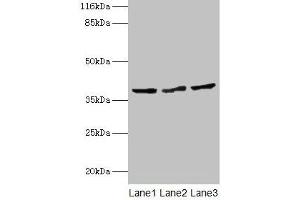 Western blot All lanes: CRYZL1 antibody at 12 μg/mL Lane 1: Hela whole cell lysate Lane 2: HepG2 whole cell lysate Lane 3: Jurkat whole cell lysate Secondary Goat polyclonal to rabbit IgG at 1/10000 dilution Predicted band size: 39, 22 kDa Observed band size: 39 kDa