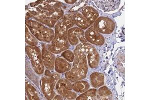 Immunohistochemical staining of human kidney with C10orf125 polyclonal antibody  shows strong cytoplasmic positivity in cells in tubules at 1:50-1:200 dilution.