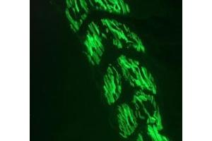 Image no. 2 for anti-Actin, alpha 1, Skeletal Muscle (ACTA1) antibody (ABIN1502284)