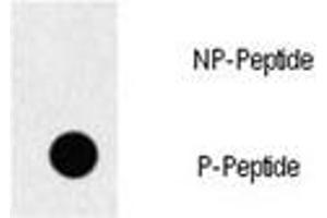 Dot blot analysis of p-EGFR antibody. (EGFR anticorps  (pTyr1069))