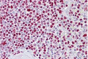 Immunohistochemistry (IHC) image for anti-Atonal Homolog 1 (Drosophila) (ATOH1) (Middle Region) antibody (ABIN2779592)