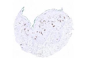 Strong CD1 immunostaining of Langerhans cells in squamous epithelium of the skin