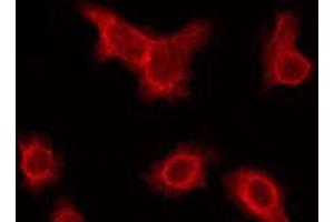 ABIN6275818 staining Hela by IF/ICC. (Cytochrome P450 2A6V2 anticorps)