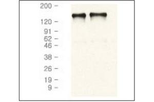 Western Blotting (WB) image for anti-Epidermal Growth Factor Receptor (EGFR) antibody (ABIN371623) (EGFR anticorps)