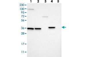 Western blot analysis of Lane 1: RT-4, Lane 2: U-251 MG, Lane 3: Human Plasma, Lane 4: Liver, Lane 5: Tonsil with MARC2 polyclonal antibody . (MARC2 anticorps)