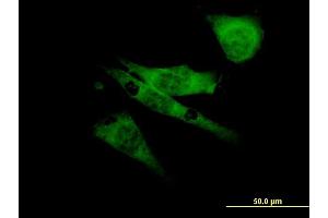 Immunofluorescence of monoclonal antibody to SCN8A on NIH/3T3 cell.
