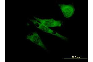 Immunofluorescence of monoclonal antibody to SCN8A on NIH/3T3 cell. (SCN8A anticorps  (AA 1854-1951))