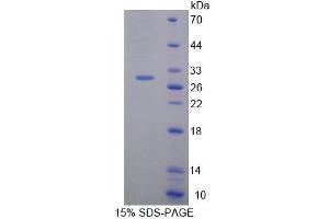SDS-PAGE analysis of Mouse HAND1 Protein. (HAND1 Protéine)