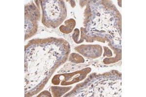 Immunohistochemical staining of human placenta with BGN polyclonal antibody  strong cytoplasmic positivity in trophoblastic cells. (Biglycan anticorps)