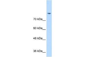 WB Suggested Anti-DLG2 Antibody Titration:  0. (DLG2 anticorps  (N-Term))