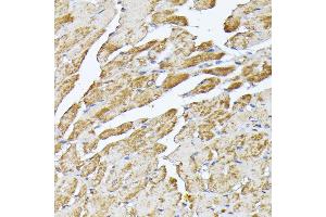 Immunohistochemistry of paraffin-embedded mouse heart using SLC25 antibody (ABIN7270430) at dilution of 1:100 (40x lens). (SLC25A5 anticorps  (AA 150-250))
