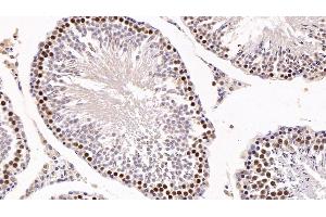 Detection of KPNa2 in Rat Testis Tissue using Polyclonal Antibody to Karyopherin Alpha 2 (KPNa2)