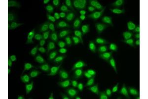 Immunofluorescence analysis of MCF-7 cell using PSMB9 antibody. (PSMB9 anticorps  (AA 1-219))