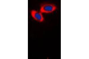 Immunofluorescent analysis of CD3d staining in Jurkat cells. (CD3D anticorps  (Center))