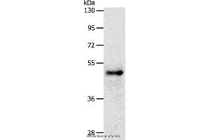Western blot analysis of Human  fetal brain tissue, using SOX8 Polyclonal Antibody at dilution of 1:500