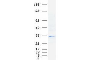 Major Histocompatibility Complex, Class II, DO beta (HLA-DOB) protein (Myc-DYKDDDDK Tag)