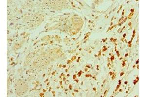 Immunohistochemistry of paraffin-embedded human epityphlon tissue using ABIN7164900 at dilution of 1:100 (TAC1 anticorps  (AA 1-129))