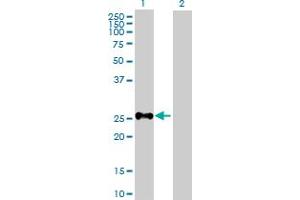 Western Blot analysis of SHOX expression in transfected 293T cell line by SHOX MaxPab polyclonal antibody. (SHOX anticorps  (AA 1-225))