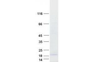 Validation with Western Blot