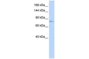 WB Suggested Anti-EVI1 Antibody Titration: 0. (MECOM anticorps  (N-Term))