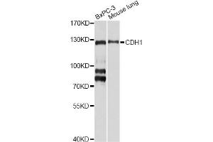 Western blot analysis of extracts of various cell lines, using CDH1 antibody (ABIN5971558) at 1/1000 dilution. (E-cadherin anticorps)