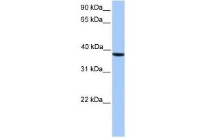 CK2 alpha antibody used at 1 ug/ml to detect target protein. (CSNK2A1/CK II alpha anticorps  (C-Term))