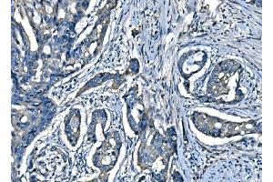 IHC analysis of SPG3A/ATL1 using anti-SPG3A/ATL1 antibody (ABIN7603095).