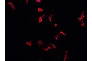 ABIN6268883 staining Raji?