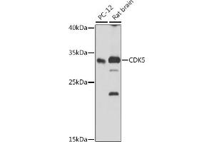 Western blot analysis of extracts of various cell lines, using CDK5 antibody (ABIN6129236, ABIN6138319, ABIN6138320 and ABIN6221397) at 1:1000 dilution.