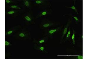 Immunofluorescence of purified MaxPab antibody to MSH2 on HeLa cell.