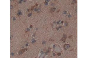 IHC-P analysis of Human Tissue, with DAB staining. (NMDAR2A anticorps  (AA 31-555))