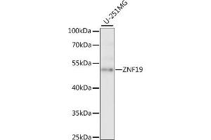 Western blot analysis of extracts of U-251MG cells, using ZNF19 antibody (ABIN7271464) at 1:1000 dilution.