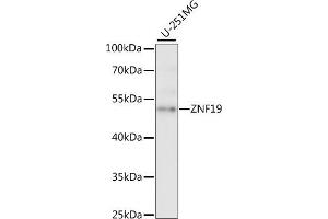 Western blot analysis of extracts of U-251MG cells, using ZNF19 antibody (ABIN7271464) at 1:1000 dilution. (ZNF19 anticorps  (AA 1-180))