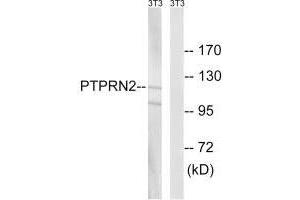 Western blot analysis of extracts from NIH/3T3 cells, using PTPRN2 antibody. (PTPRN2 anticorps)