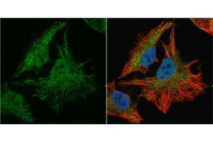 ICC/IF Image SOD1 antibody detects SOD1 protein at cytoplasm and nucleus by immunofluorescent analysis. (SOD1 anticorps  (C-Term))