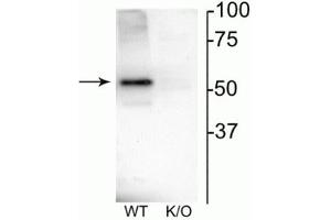 Western blot of mouse habenula lysate showing specific immunolabeling of the ~52 kDa nAChRβ4 protein. (CHRNB4 anticorps  (Cytoplasmic Loop))