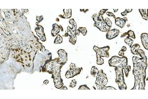 IHC analysis of CDC123 using anti-CDC123 antibody (ABIN7599284). (CDC123 anticorps  (AA 1-336))