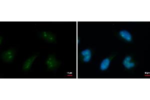 anti-DEAD (Asp-Glu-Ala-Asp) Box Polypeptide 18 (DDX18) (Center) antibody