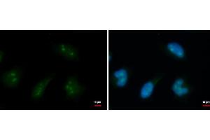 ICC/IF Image DDX18 antibody detects DDX18 protein at nucleolus by immunofluorescent analysis. (DDX18 anticorps  (Center))