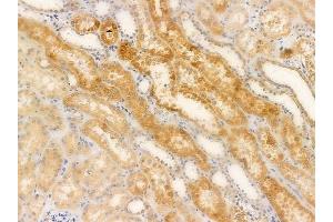 ABIN6263743 and ABIN6266602 at 1/100 staining human normal kidney tissue by IHC-P.