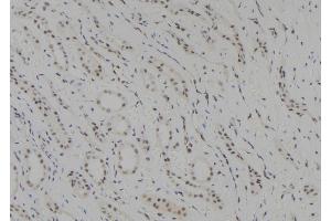 ABIN6278405 at 1/100 staining Human kidney tissue by IHC-P. (SUV39H1 anticorps  (C-Term))
