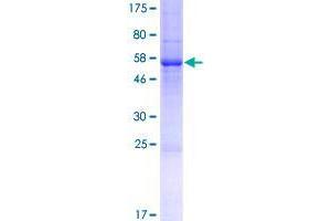 Retbindin (RTBDN) (AA 1-261) protein (GST tag)