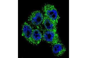Immunofluorescence (IF) image for anti-Transient Receptor Potential Cation Channel, Subfamily M, Member 8 (TRPM8) antibody (ABIN2996363) (TRPM8 anticorps)