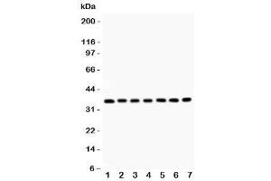 Western blot testing of RACK1 antibody and Lane 1:  mouse liver (GNB2L1 anticorps  (AA 2-317))