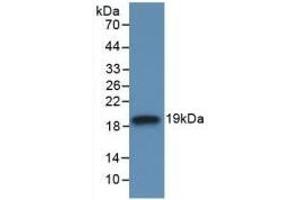 Detection of Recombinant IL18BP, Human using Monoclonal Antibody to Interleukin 18 Binding Protein (IL18BP) (IL18BP anticorps  (AA 31-194))