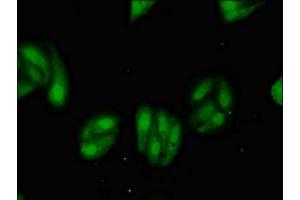 anti-Microsomal Glutathione S-Transferase 2 (MGST2) (AA 27-57) antibody